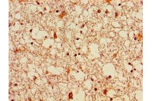 Immunohistochemistry of paraffin-embedded human brain tissue using ABIN7152811 at dilution of 1:100 (FGF22 anticorps  (AA 23-170))