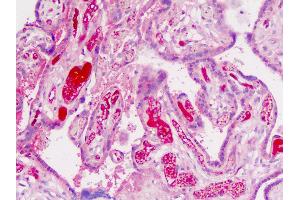 Human Placenta: Formalin-Fixed, Paraffin-Embedded (FFPE)