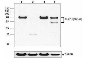 Western Blotting (WB) image for anti-Th-POK antibody (ABIN2665409) (Th-POK anticorps)