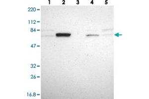 Western blot analysis of Lane 1: RT-4, Lane 2: U-251 MG, Lane 3: Human Plasma, Lane 4: Liver, Lane 5: Tonsil with GRHL1 polyclonal antibody  at 1:250-1:500 dilution. (GRHL1 anticorps)