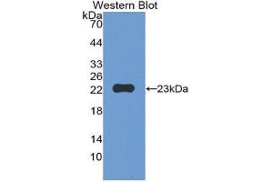 Western Blotting (WB) image for anti-Matrix Metallopeptidase 12 (Macrophage Elastase) (MMP12) (AA 294-473) antibody (ABIN1172854) (MMP12 anticorps  (AA 294-473))