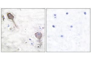 Immunohistochemistry (IHC) image for anti-Parkinson Protein 2, E3 Ubiquitin Protein Ligase (Parkin) (PARK2) (N-Term) antibody (ABIN1848726) (Parkin anticorps  (N-Term))
