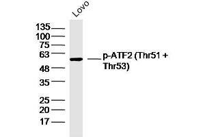 LOVO lysates probed with p-ATF2 (Thr51 + Thr53) Polyclonal Antibody, Unconjugated  at 1:300 dilution and 4˚C overnight incubation. (ATF2 anticorps  (pThr51, pThr53))