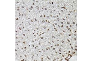 Immunohistochemistry of paraffin-embedded mouse liver using KDM4A antibody (ABIN6131821, ABIN6142793, ABIN6142795 and ABIN6223960) at dilution of 1:100 (40x lens). (KDM4A anticorps  (AA 585-815))
