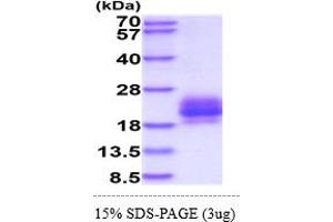 SDS-PAGE (SDS) image for B and T Lymphocyte Associated (BTLA) (AA 31-157) protein (His tag) (ABIN7281321)
