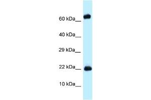 WB Suggested Anti-Zfp580 Antibody Titration: 1. (ZNF580 anticorps  (Middle Region))