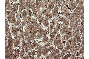 Image no. 6 for anti-Transmembrane Protein 173 (TMEM173) antibody (ABIN1501428)