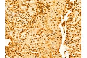 ABIN6263918 and ABIN6273062 at 1/100 staining Rat kidney tissue by IHC-P. (OTUD7B anticorps  (C-Term))