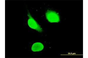 Immunofluorescence of monoclonal antibody to IKZF3 on HeLa cell. (IKZF3 anticorps  (AA 1-509))
