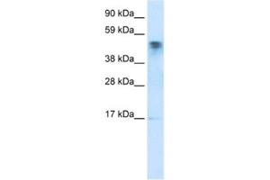 Western Blotting (WB) image for anti-FLJ13798 (FLJ13798) antibody (ABIN2460760) (FLJ13798 (FLJ13798) anticorps)