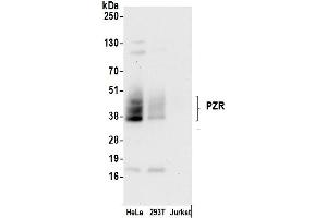 Western Blotting (WB) image for anti-Myelin Protein Zero-Like 1 (MPZL1) (AA 225-275) antibody (ABIN7450624)