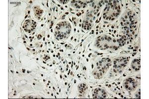 Immunohistochemical staining of paraffin-embedded breast tissue using anti-L1CAM mouse monoclonal antibody. (L1CAM anticorps)