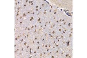 Immunohistochemistry of paraffin-embedded mouse brain using RAD1 antibody at dilution of 1:200 (400x lens).