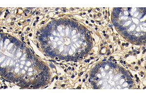 Detection of TGFb1 in Human Rectum Tissue using Polyclonal Antibody to Transforming Growth Factor Beta 1 (TGFb1)