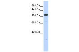 Image no. 1 for anti-Zinc Finger Protein 112 (ZFP112) (N-Term) antibody (ABIN6740571) (ZFP112 anticorps  (N-Term))