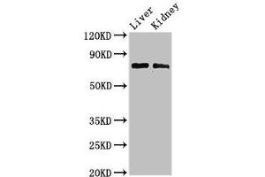 Western Blot Positive WB detected in: Mouse liver tissue, Mouse kidney tissue All lanes: PHF21A antibody at 3 μg/mL Secondary Goat polyclonal to rabbit IgG at 1/50000 dilution Predicted band size: 75, 71 kDa Observed band size: 75 kDa (PHF21A anticorps  (AA 312-487))