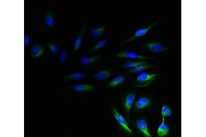 Immunofluorescent analysis of Hela cells using ABIN7161207 at dilution of 1:100 and Alexa Fluor 488-congugated AffiniPure Goat Anti-Rabbit IgG(H+L)