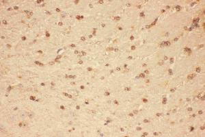 Anti-CNTF Picoband antibody, IHC(P): Mouse Brain Tissue