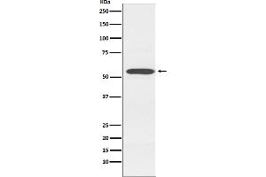 Western blot analysis of Cytochrome P450 2D6 expression in K562 cell lysate.