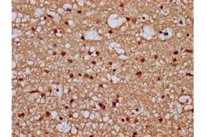 IHC image of ABIN7171666 diluted at 1:300 and staining in paraffin-embedded human brain tissue performed on a Leica BondTM system. (Tiparp anticorps  (AA 74-178))
