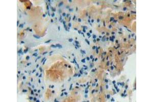 IHC-P analysis of lung tissue, with DAB staining. (DOCK2 anticorps  (AA 390-635))