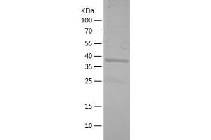 Western Blotting (WB) image for Arrestin 3, Retinal (X-Arrestin) (ARR3) (AA 87-213) protein (His-IF2DI Tag) (ABIN7121896) (ARR3 Protein (AA 87-213) (His-IF2DI Tag))