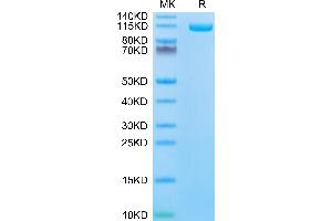 Biotinylated Human ENPP-1 on Tris-Bis PAGE under reduced condition. (ENPP1 Protein (AA 98-925) (His-Avi Tag,Biotin))