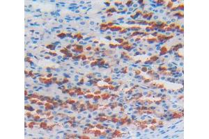 Used in DAB staining on fromalin fixed paraffin- embedded stomach tissue (LOXL2 anticorps  (AA 553-761))