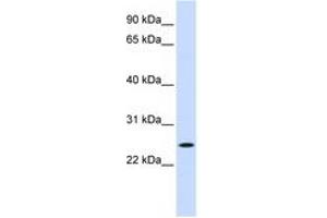 Image no. 1 for anti-Nucleolar Protein 3 (Apoptosis Repressor with CARD Domain) (NOL3) (C-Term) antibody (ABIN6744368) (NOL3 anticorps  (C-Term))
