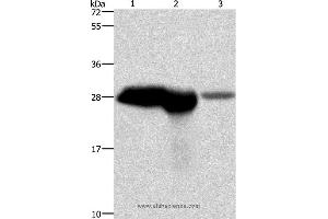 Western blot analysis of Mouse brain and kidney tissue, human fetal brain tissue, using CALB1 Polyclonal Antibody at dilution of 1:750 (CALB1 anticorps)