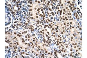 Immunohistochemistry (IHC) image for anti-Ras Suppressor Protein 1 (RSU1) (C-Term) antibody (ABIN2783331)
