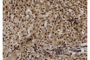 ABIN6272981 at 1/100 staining Human liver tissue by IHC-P. (SULT1E1 anticorps  (Internal Region))