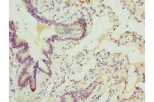 Immunohistochemistry of paraffin-embedded human lung tissue using ABIN7144880 at dilution of 1:100 (ABCA3 anticorps  (AA 43-203))