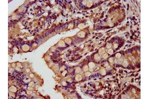 IHC image of ABIN7172782 diluted at 1:800 and staining in paraffin-embedded human small intestine tissue performed on a Leica BondTM system.