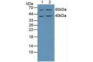Western blot analysis of (1) Human Jurkat Cells and (2) Human HeLa cells. (TRADD anticorps  (AA 61-297))