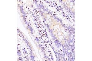 Immunohistochemistry of paraffin embedded rat ileum using ASBT (ABIN7075648) at dilution of 1:1500 (400x lens) (SLC10A2 anticorps)