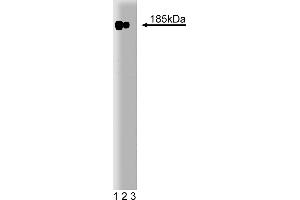 Western Blotting (WB) image for anti-Receptor tyrosine-protein kinase erbB-2 (ErbB2/Her2) (AA 182-373) antibody (ABIN967787)