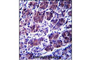 CCDC22 Antibody (C-term) (ABIN657403 and ABIN2846443) immunohistochemistry analysis in formalin fixed and paraffin embedded human stomach tissue followed by peroxidase conjugation of the secondary antibody and DAB staining. (CCDC22 anticorps  (C-Term))