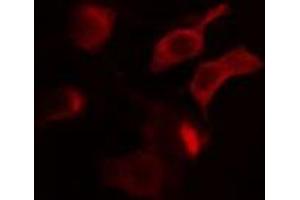ABIN6275002 staining MCF7 cells by IF/ICC. (CLCN4 anticorps  (Internal Region))