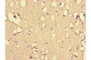 Immunohistochemistry of paraffin-embedded human brain tissue using ABIN7151461 at dilution of 1:100