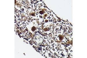 Immunohistochemistry of paraffin-embedded rat bone marrow using CXCL4/PF4 Rabbit pAb (ABIN7269400) at dilution of 1:50 (40x lens). (PF4 anticorps)