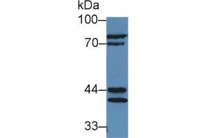 Detection of PAP in Mouse Testis lysate using Polyclonal Antibody to Prostatic Acid Phosphatase (PAP) (ACPP anticorps  (AA 56-215))