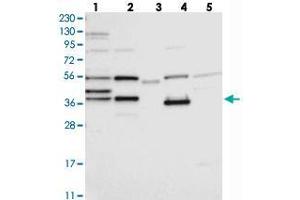 Western blot analysis of Lane 1: RT-4, Lane 2: U-251 MG, Lane 3: Human Plasma, Lane 4: Liver, Lane 5: Tonsil with ZCWPW2 polyclonal antibody . (ZCWPW2 anticorps)