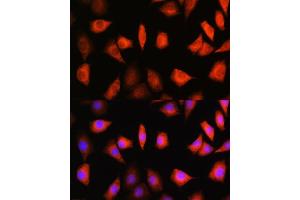 Immunofluorescence analysis of L929 cells using KIF Rabbit pAb (ABIN1680591, ABIN3019005, ABIN3019006 and ABIN6220670) at dilution of 1:100. (KIFAP3 anticorps  (AA 1-200))