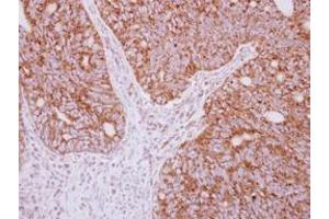 Image no. 1 for anti-Tyrosyl-tRNA Synthetase 2, Mitochondrial (YARS2) (AA 1-227) antibody (ABIN1501788)