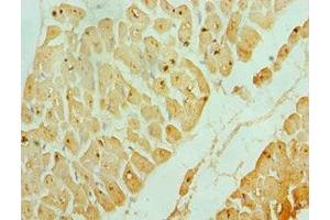 Immunohistochemistry of paraffin-embedded human heart tissue using ABIN7142987 at dilution of 1:100