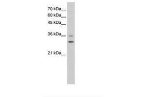 anti-Forkhead Box Q1 (FOXQ1) (N-Term) antibody