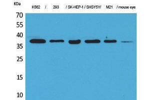 Western Blotting (WB) image for anti-Ribosomal RNA Processing 7 Homolog A (RRP7A) (C-Term) antibody (ABIN3178144) (RRP7A anticorps  (C-Term))