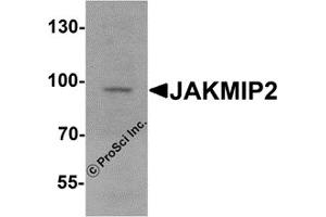 Western Blotting (WB) image for anti-Janus Kinase and Microtubule Interacting Protein 2 (JAKMIP2) antibody (ABIN1077420) (JAKMIP2 anticorps)