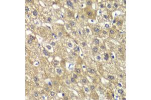 Immunohistochemistry of paraffin-embedded human liver injury using MYBPC2 antibody (ABIN6291568) at dilution of 1:100 (40x lens).